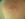 Sonnenbrand 2932948.JPG